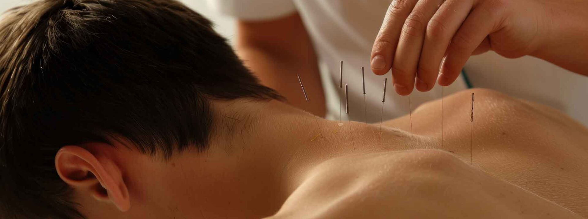 Dry Needling for Neck Pain: Restoring Comfort and Movement